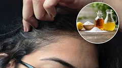 Care sunt avantajele utilizării oțetului și a bicarbonatului de sodiu pentru a elimina părul alb și cum se procedează corect?